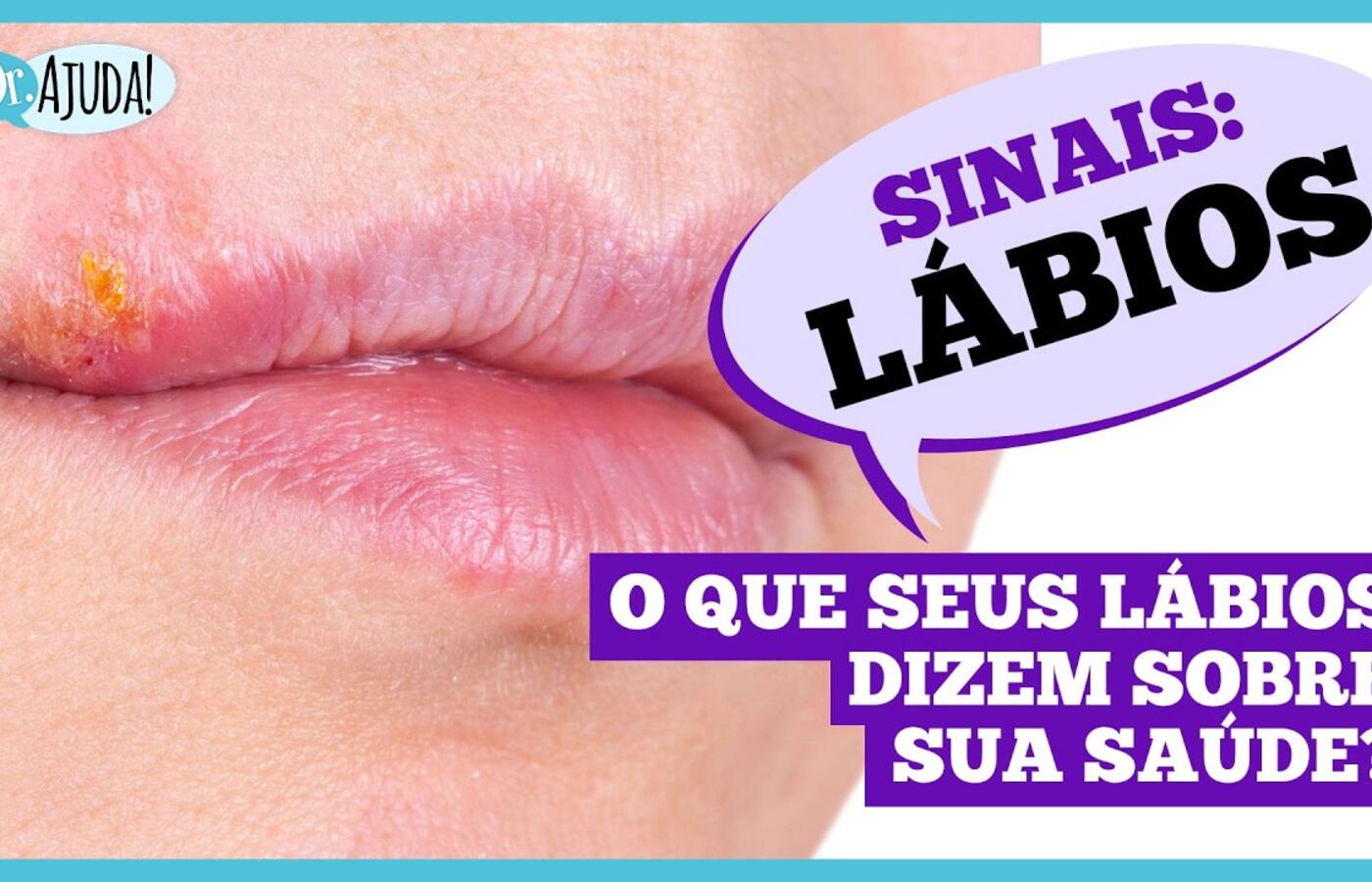 Sinais: Lábios