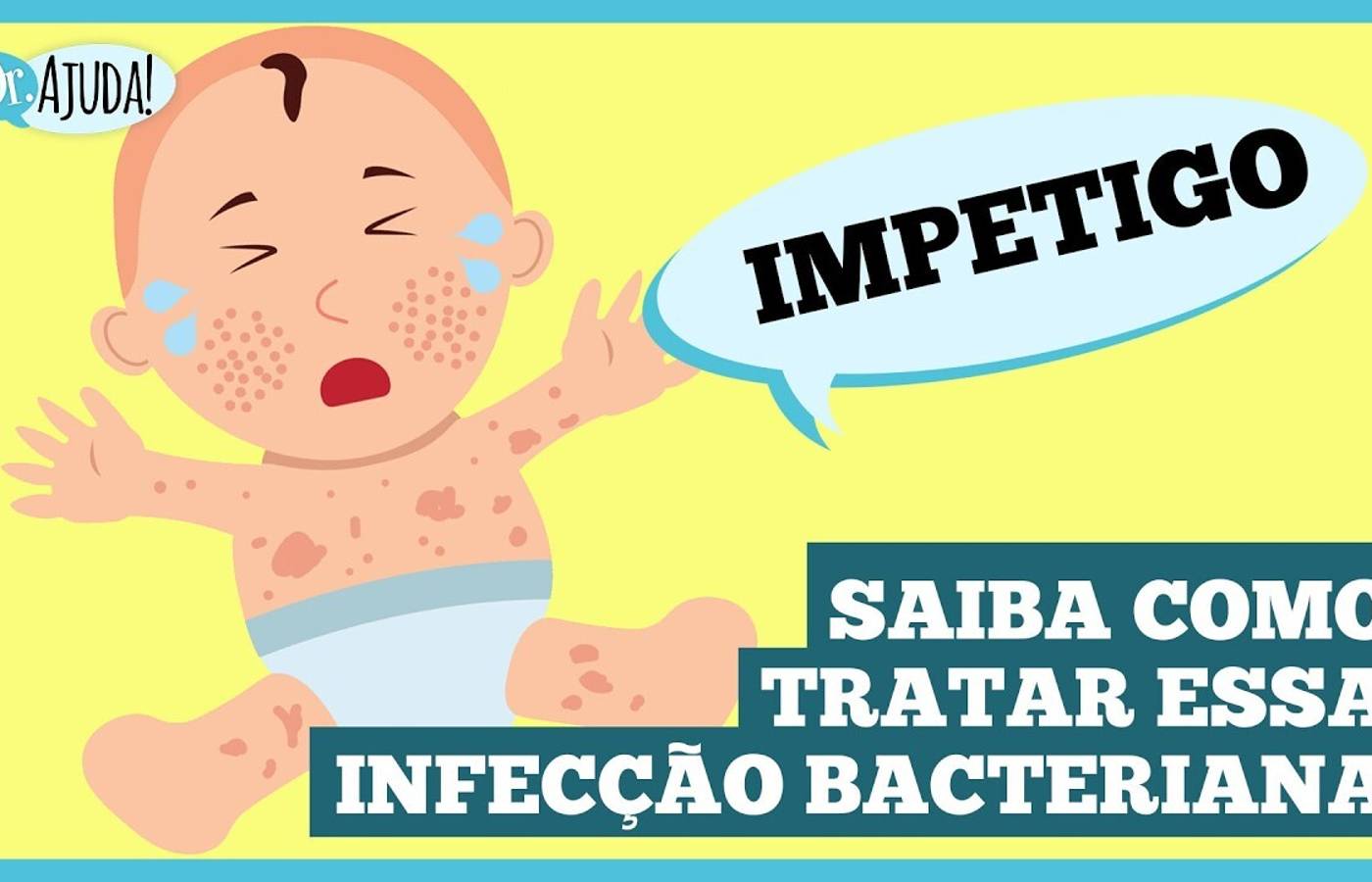 Impetigo: A infecção de pele comum em crianças! Saiba como tratar