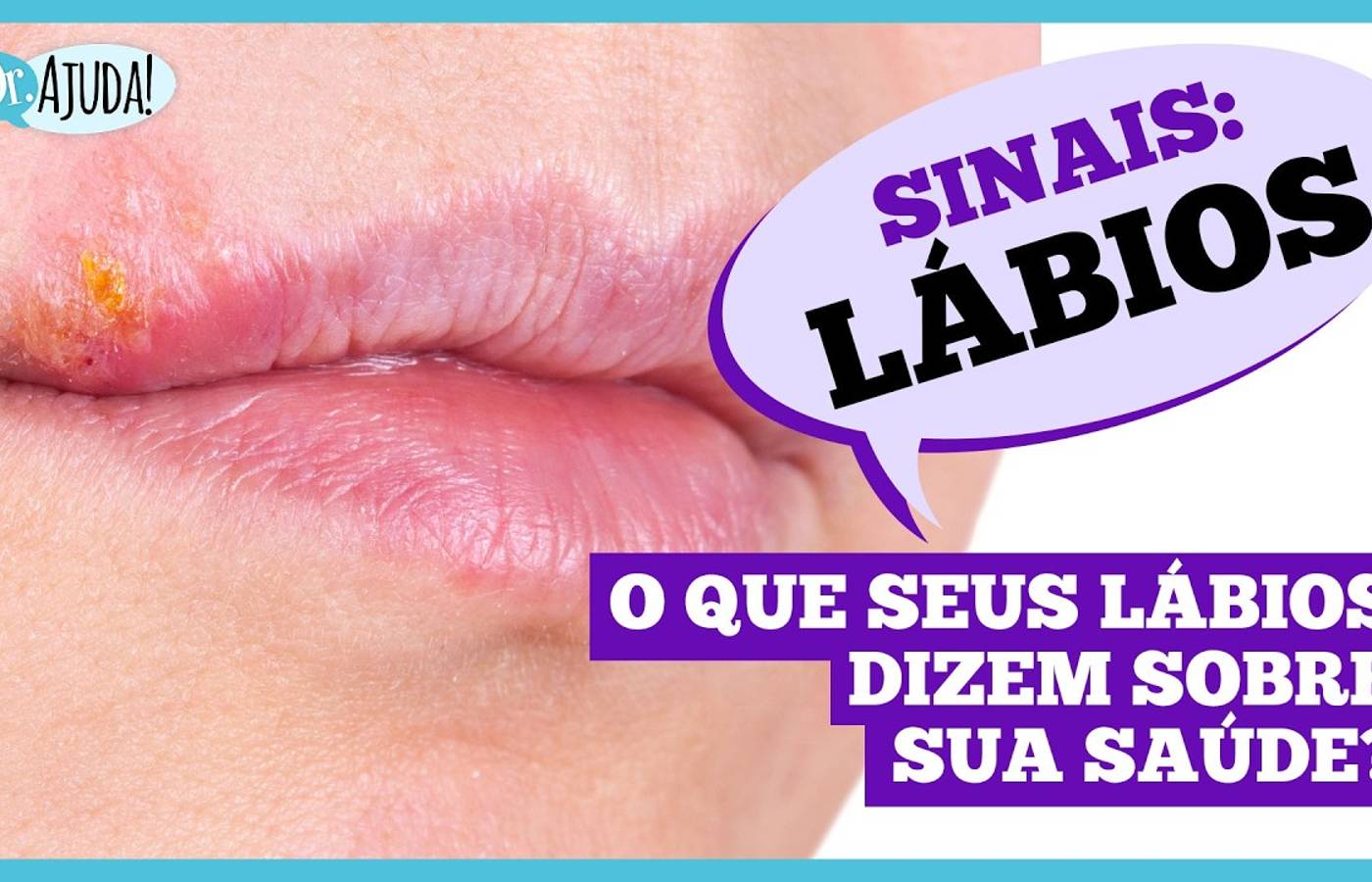 Sinais: Lábios