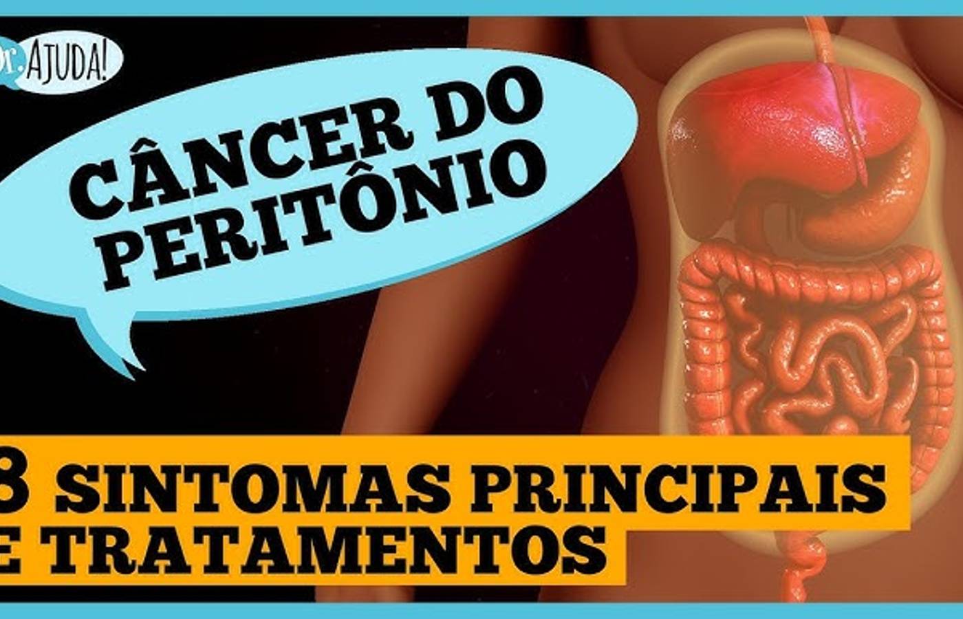 Câncer de peritônio: diagnóstico, tratamento e prognóstico